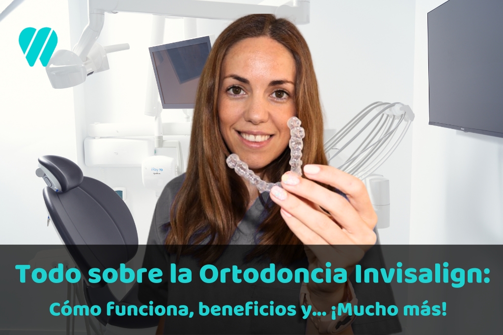 Todo sobre la ortodoncia Invisalign: Cómo funciona, beneficios, tipos y mucho más