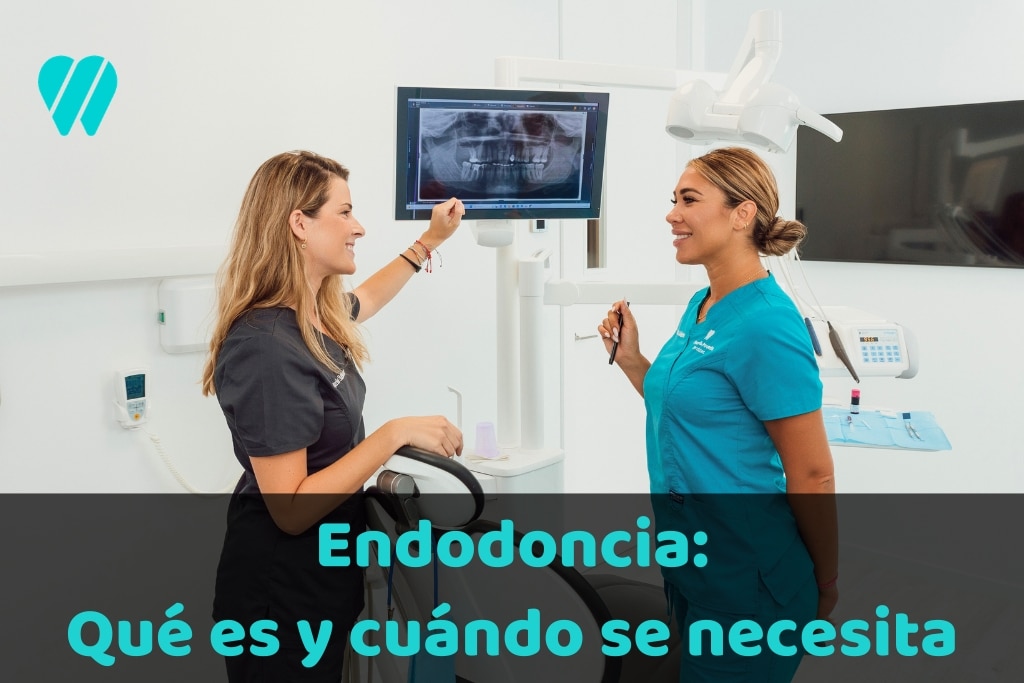 Endodoncia: qué es, cuándo se necesita y por qué ya no hay que temerle al ‘matar el nervio’
